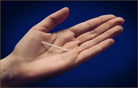 The Pros and Cons of Using a Contraceptive Implant